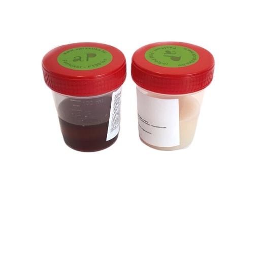 [APU002] F190 Polyurethane Resin, 100g